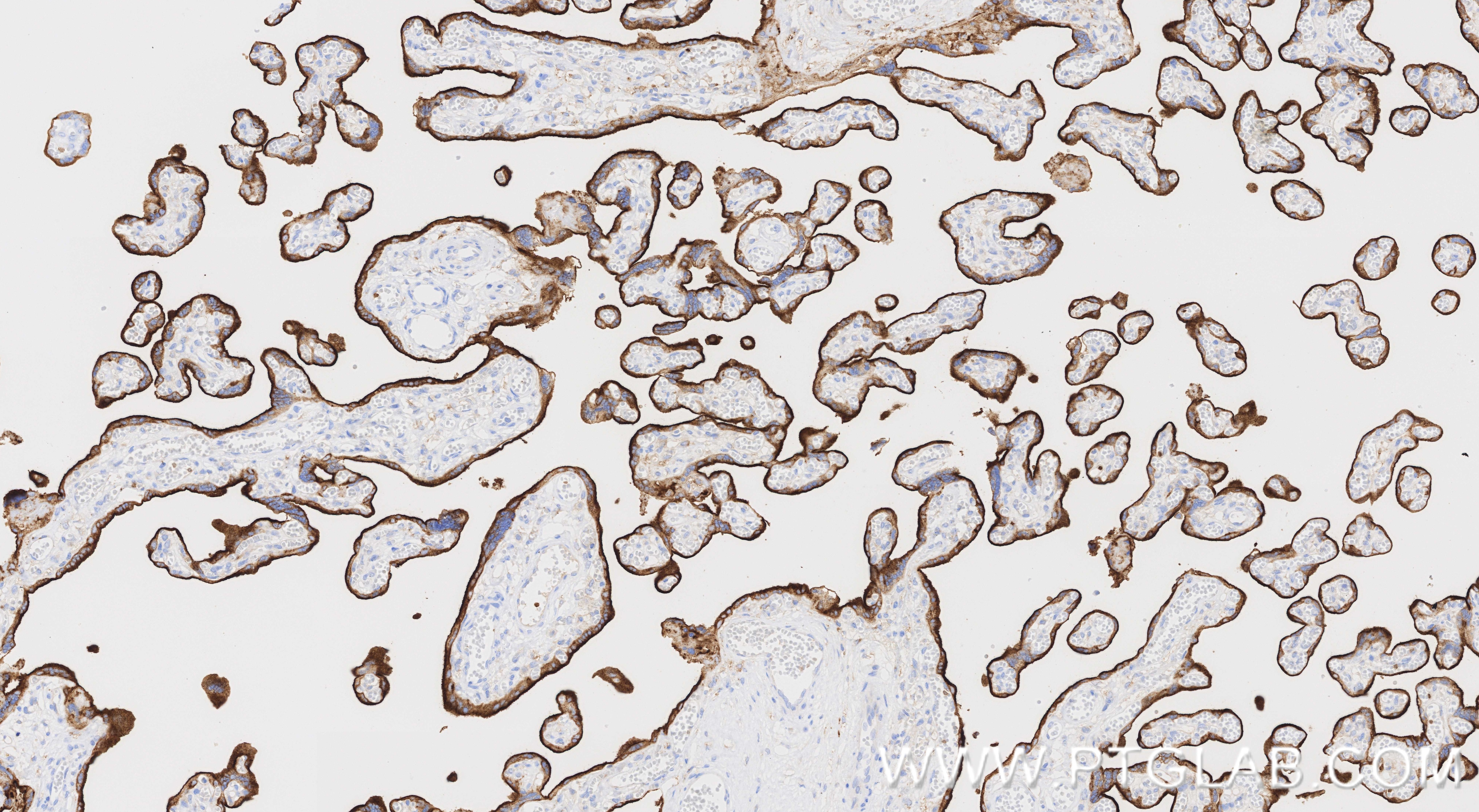 Immunohistochemistry (IHC) staining of human placenta tissue using CD71 Recombinant monoclonal antibody (81793-3-RR)