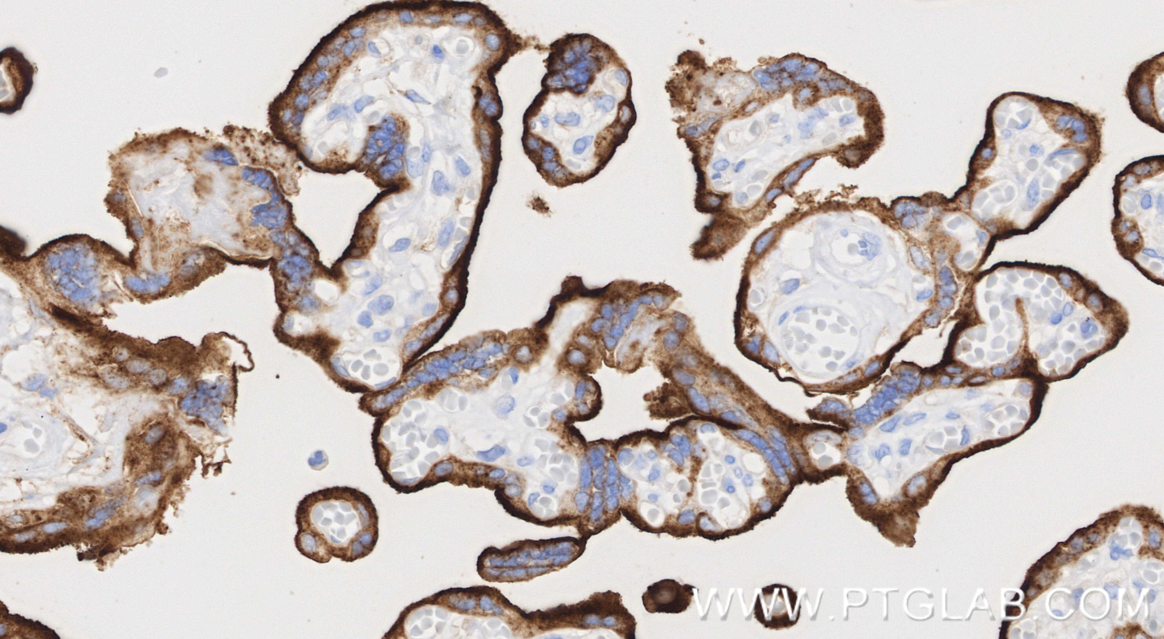 Immunohistochemistry (IHC) staining of human placenta tissue using CD71 Recombinant monoclonal antibody (81793-3-RR)