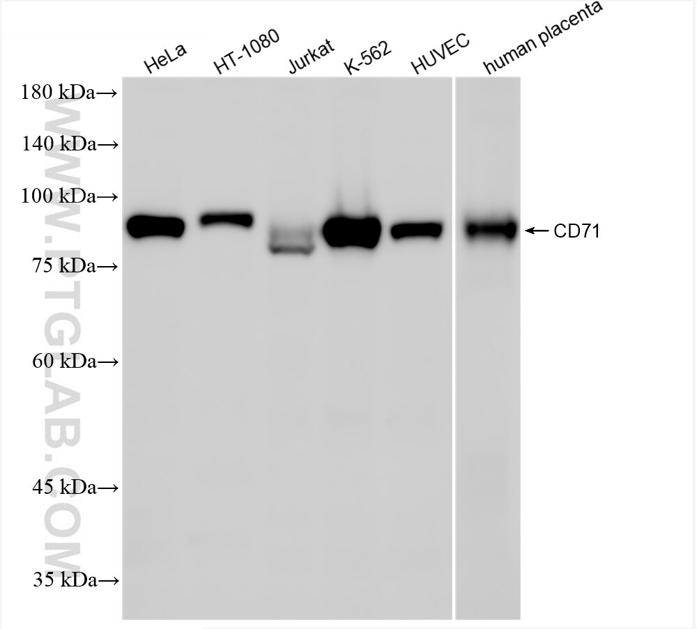 Western Blot (WB) analysis of various lysates using CD71 Recombinant antibody (81793-5-RR)