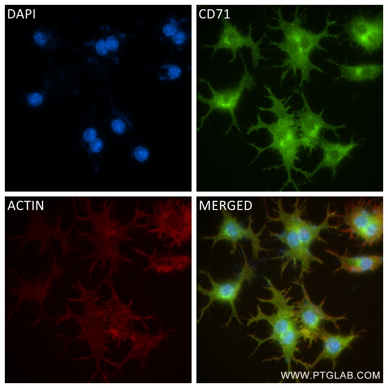 Immunofluorescence (IF) / fluorescent staining of RAW 264.7 cells using CD71 Recombinant antibody (84766-3-RR)