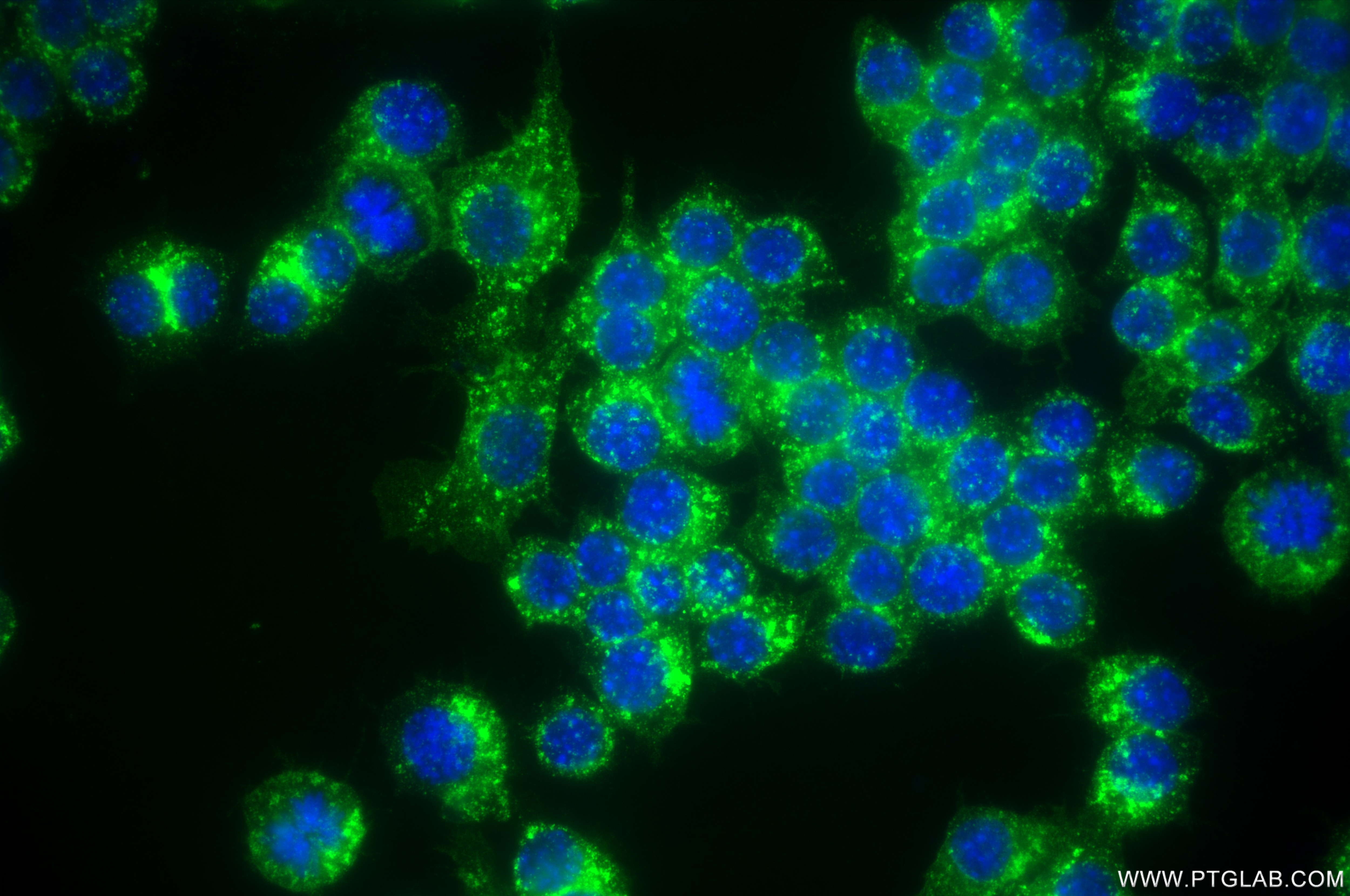 Immunofluorescence (IF) / fluorescent staining of RAW 264.7 cells using CD71 Recombinant antibody (84766-4-RR)