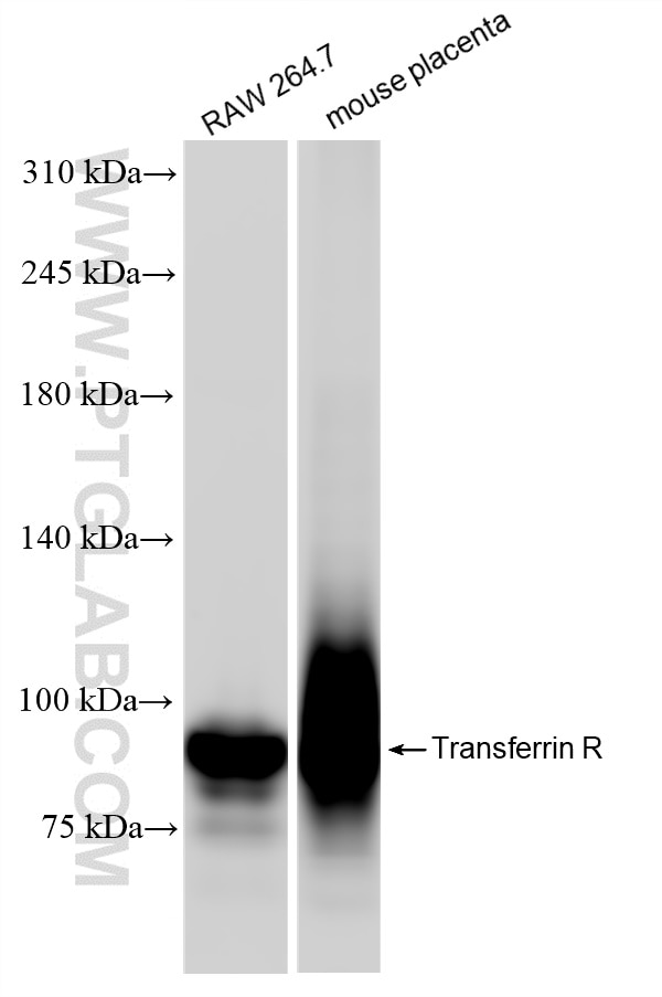 Western Blot (WB) analysis of various lysates using CD71 Recombinant antibody (84766-4-RR)