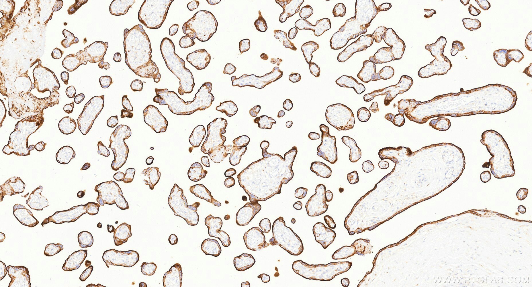 IHC staining of human placenta using Biotin-81793-13 Immunohistochemistry (IHC) staining of human placenta tissue using Biotin-conjugated CD71 Recombinant monoclonal anti (Biotin-81793-13)
