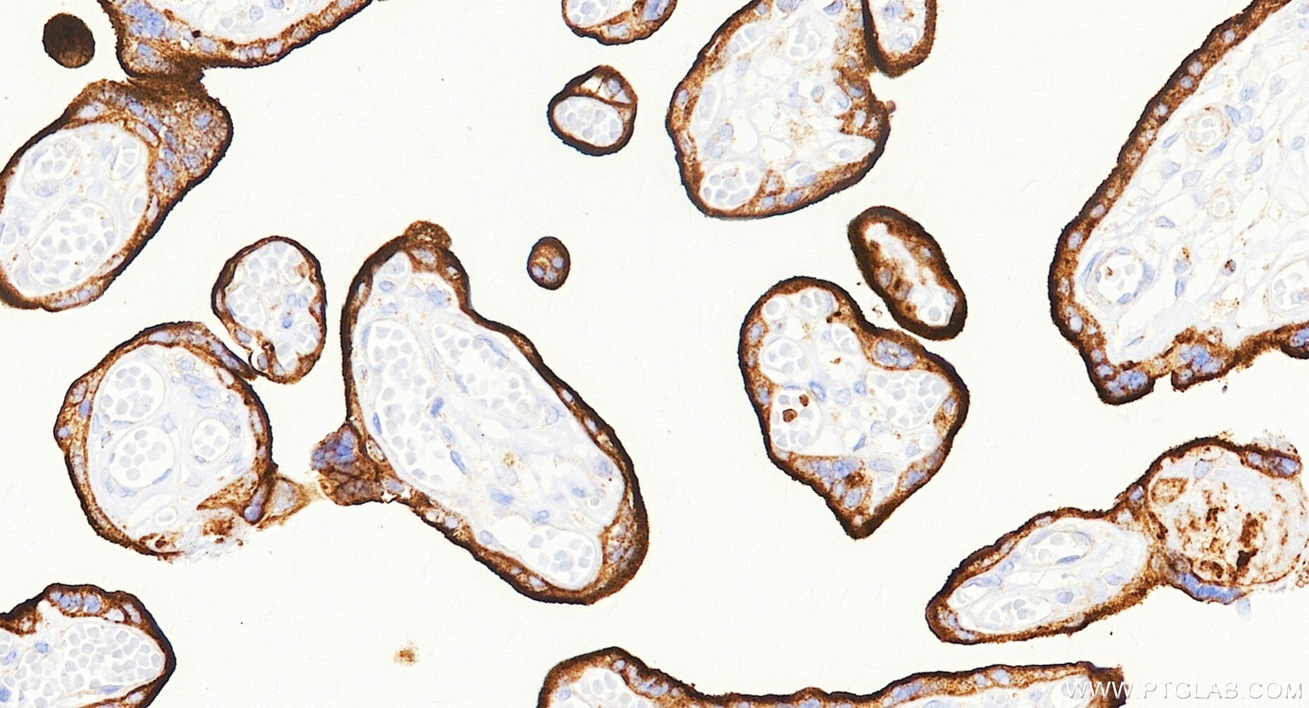 IHC staining of human placenta using Biotin-81793-13 Immunohistochemistry (IHC) staining of human placenta tissue using Biotin-conjugated CD71 Recombinant monoclonal anti (Biotin-81793-13)