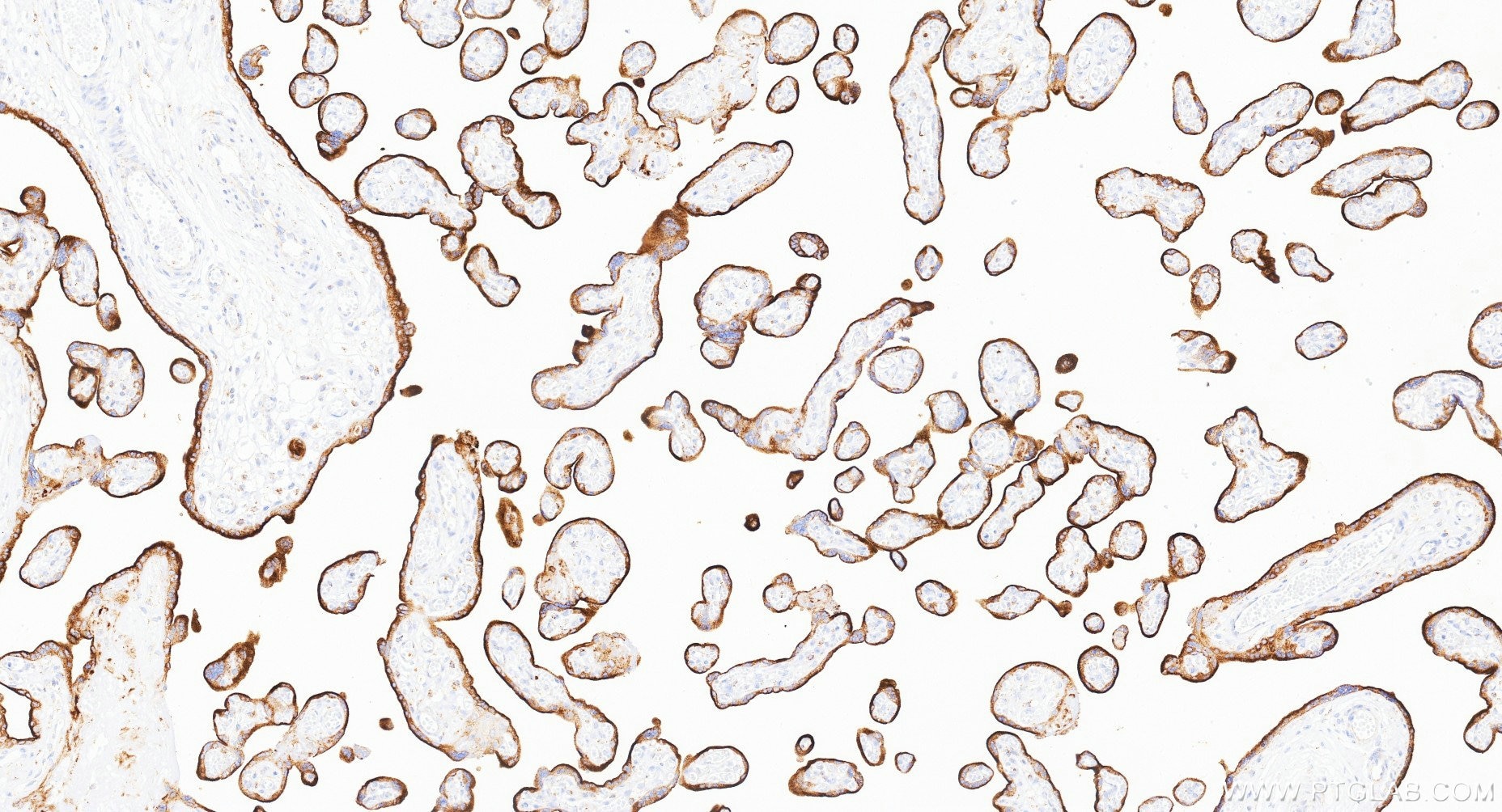 IHC staining of human placenta using Biotin-81793-14 Immunohistochemistry (IHC) staining of human placenta tissue using Biotin-conjugated CD71 Recombinant monoclonal anti (Biotin-81793-14)