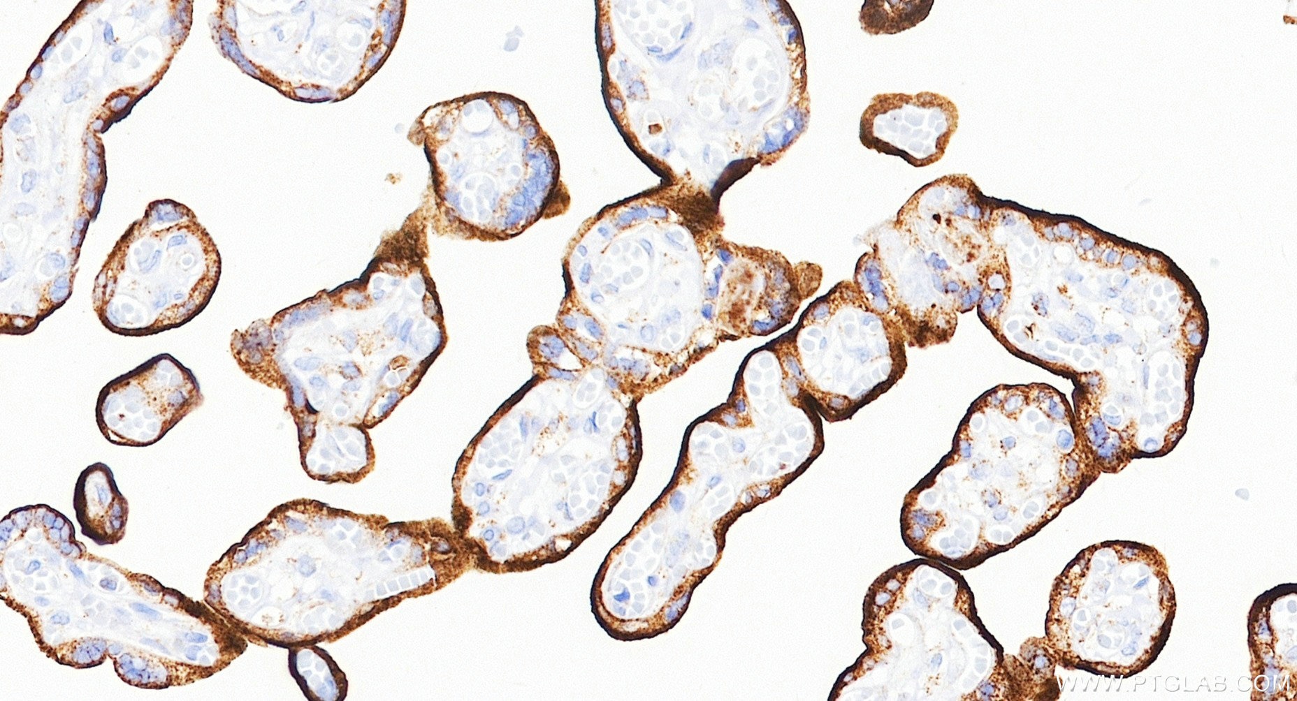 IHC staining of human placenta using Biotin-81793-14 Immunohistochemistry (IHC) staining of human placenta tissue using Biotin-conjugated CD71 Recombinant monoclonal anti (Biotin-81793-14)