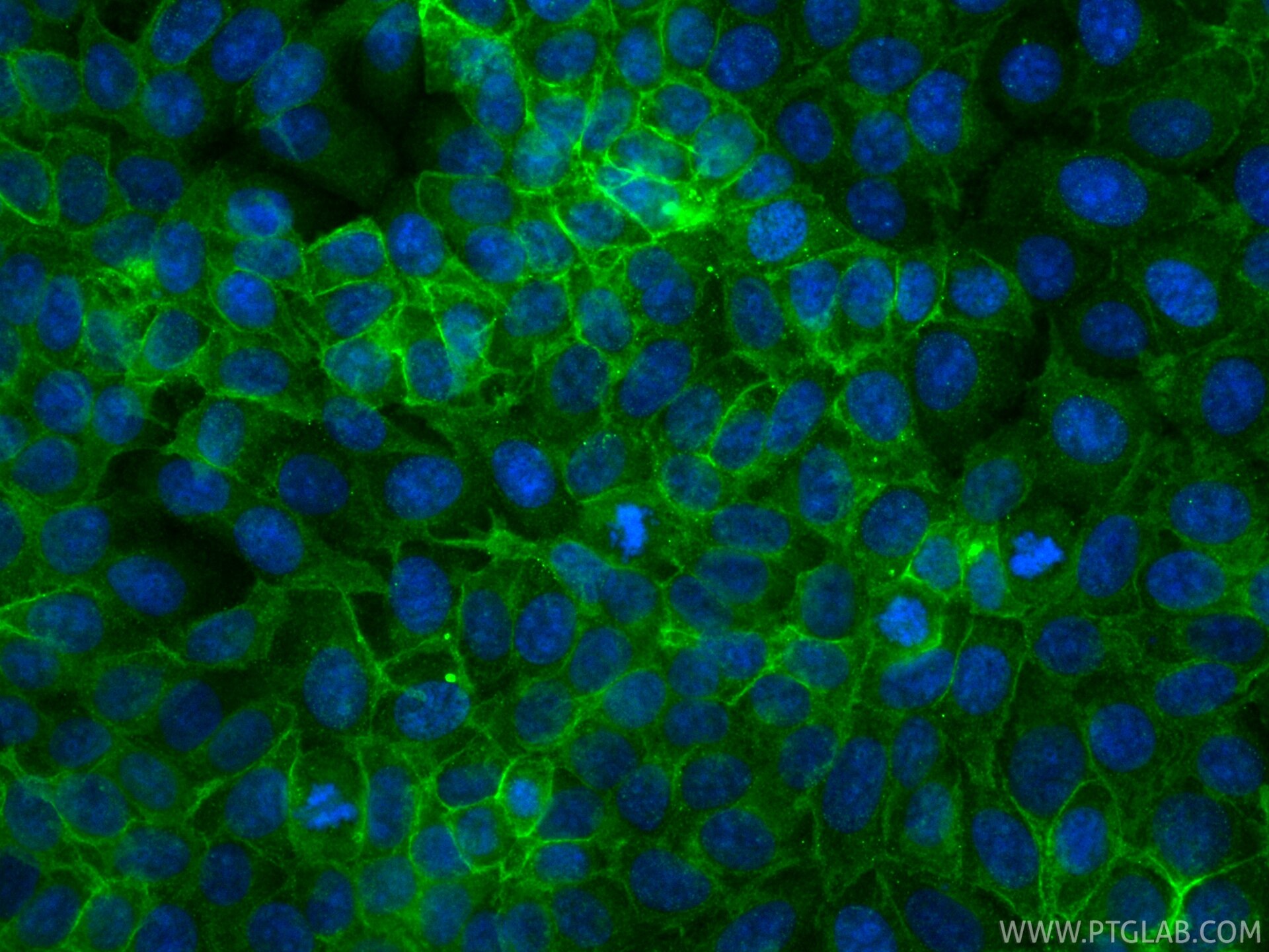 IF Staining of MCF-7 using CL488-81793-13 Immunofluorescence (IF) / fluorescent staining of MCF-7 cells using CoraLite® Plus 488-conjugated CD71 Recombinant mon (CL488-81793-13)