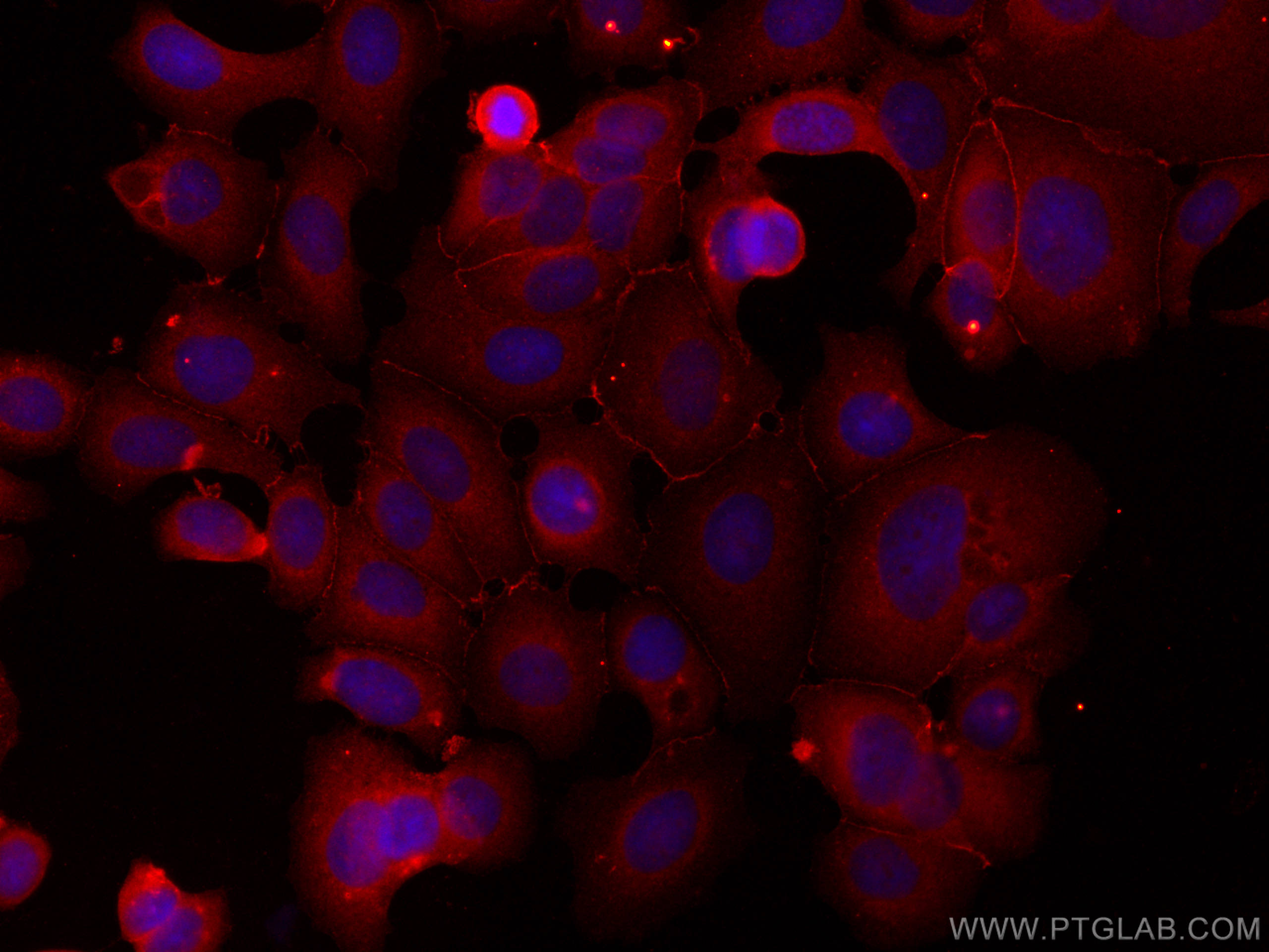 Immunofluorescence (IF) / fluorescent staining of MCF-7 cells using CoraLite®594-conjugated CD71 Monoclonal antibody (CL594-66180)
