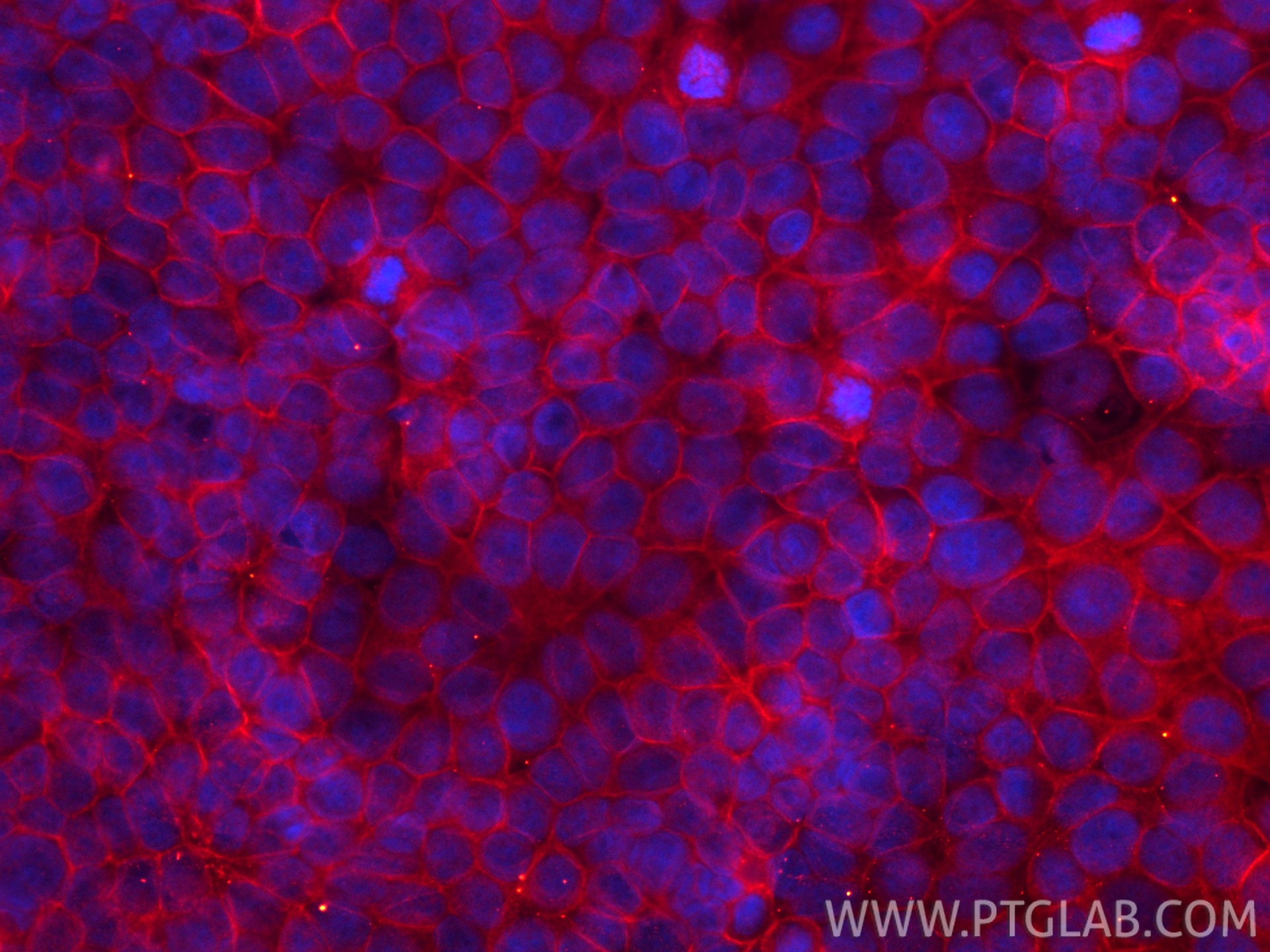 IF Staining of MCF-7 using CL594-66180 Immunofluorescence (IF) / fluorescent staining of MCF-7 cells using CoraLite®594-conjugated CD71 Monoclonal antibody (CL594-66180)