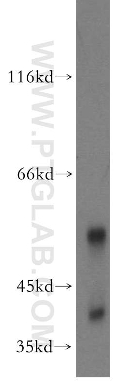 Western Blot (WB) analysis of mouse testis tissue using CD72 Polyclonal antibody (13469-1-AP)