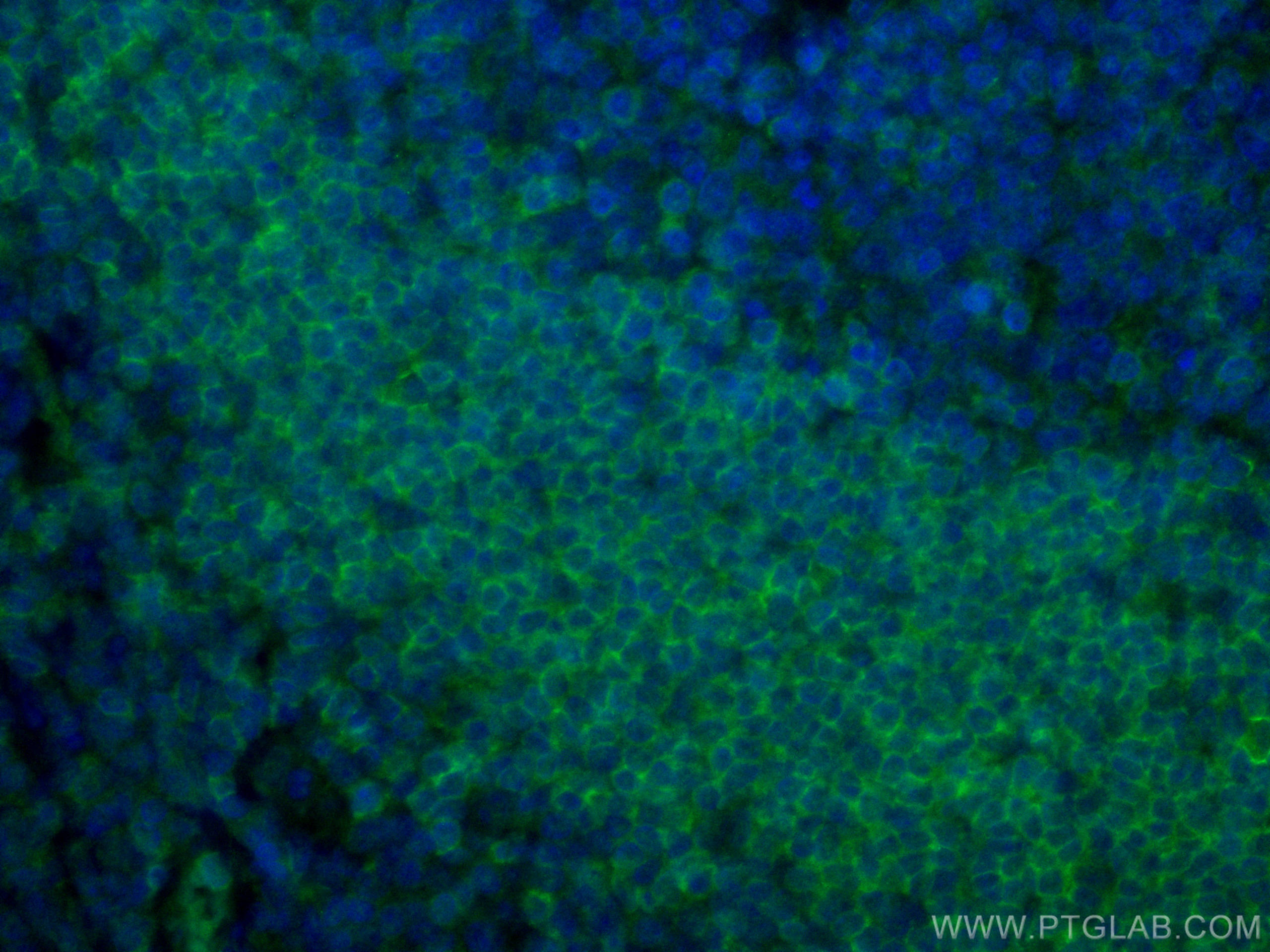 Immunofluorescence (IF) / fluorescent staining of human tonsillitis tissue using CD72 Monoclonal antibody (67424-1-Ig)