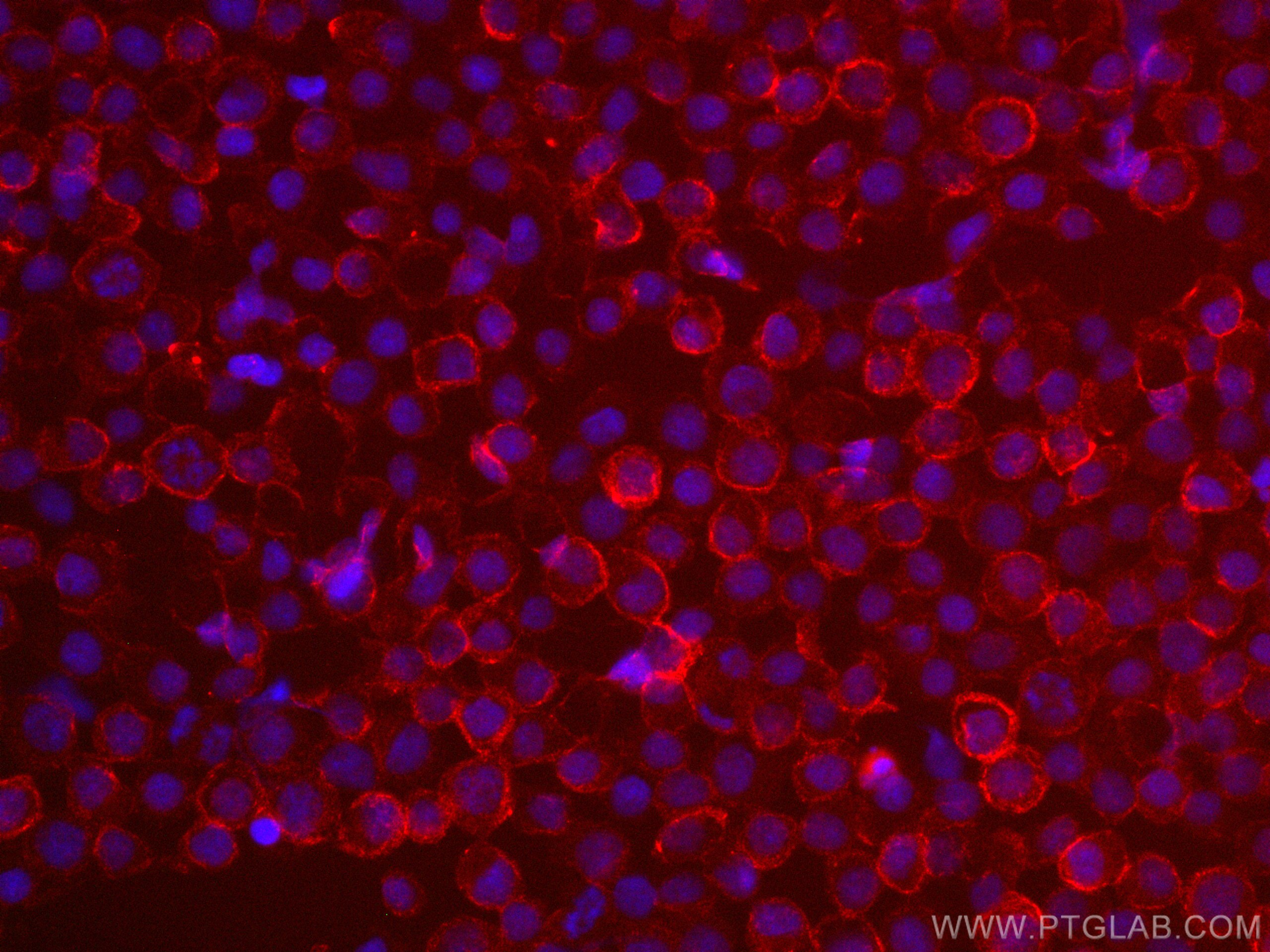 Immunofluorescence (IF) / fluorescent staining of Ramos cells using CD72 Monoclonal antibody (67424-1-Ig)