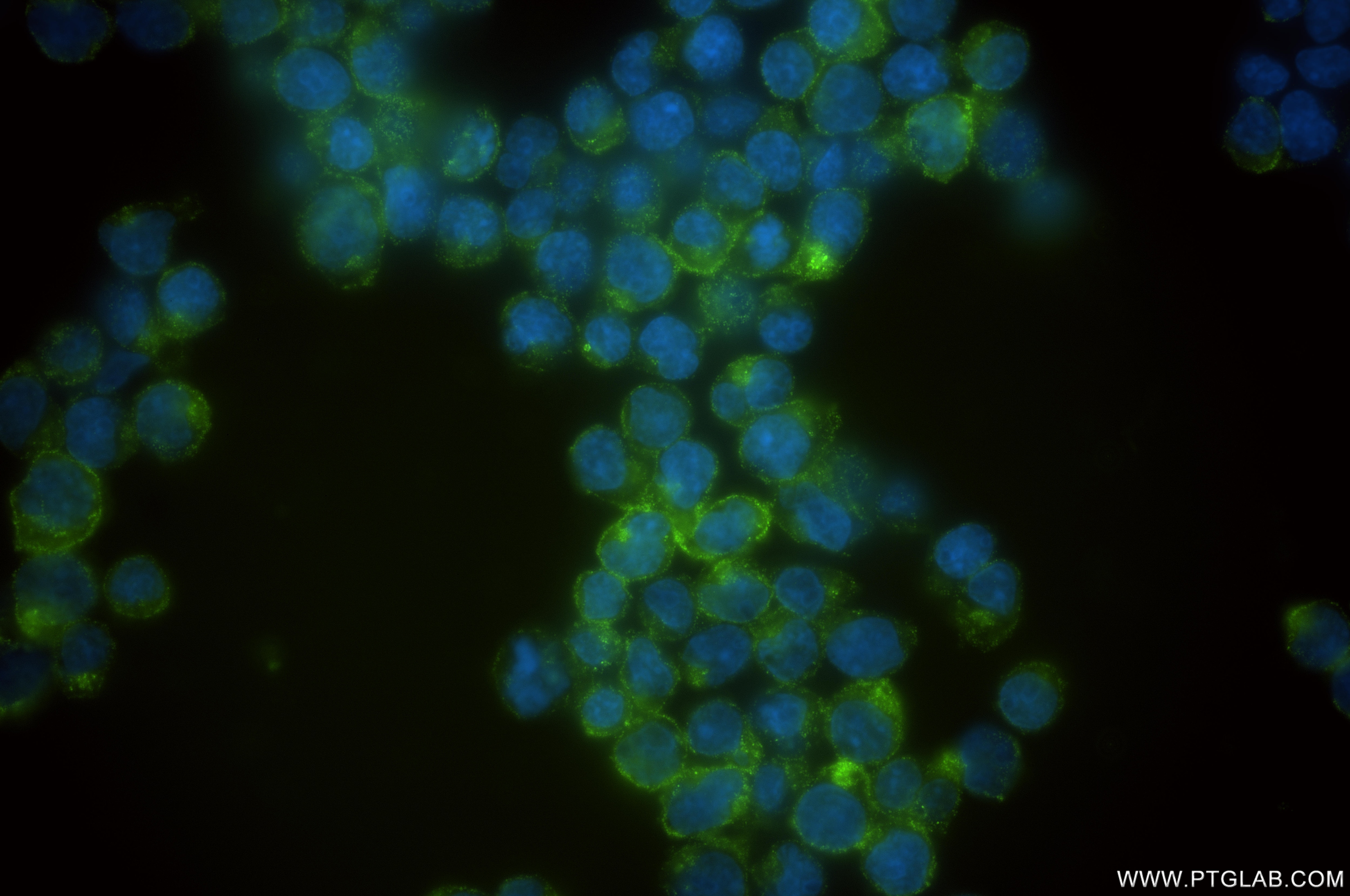 Immunofluorescence (IF) / fluorescent staining of Ramos cells using CD72 Recombinant monoclonal antibody (84270-5-RR)