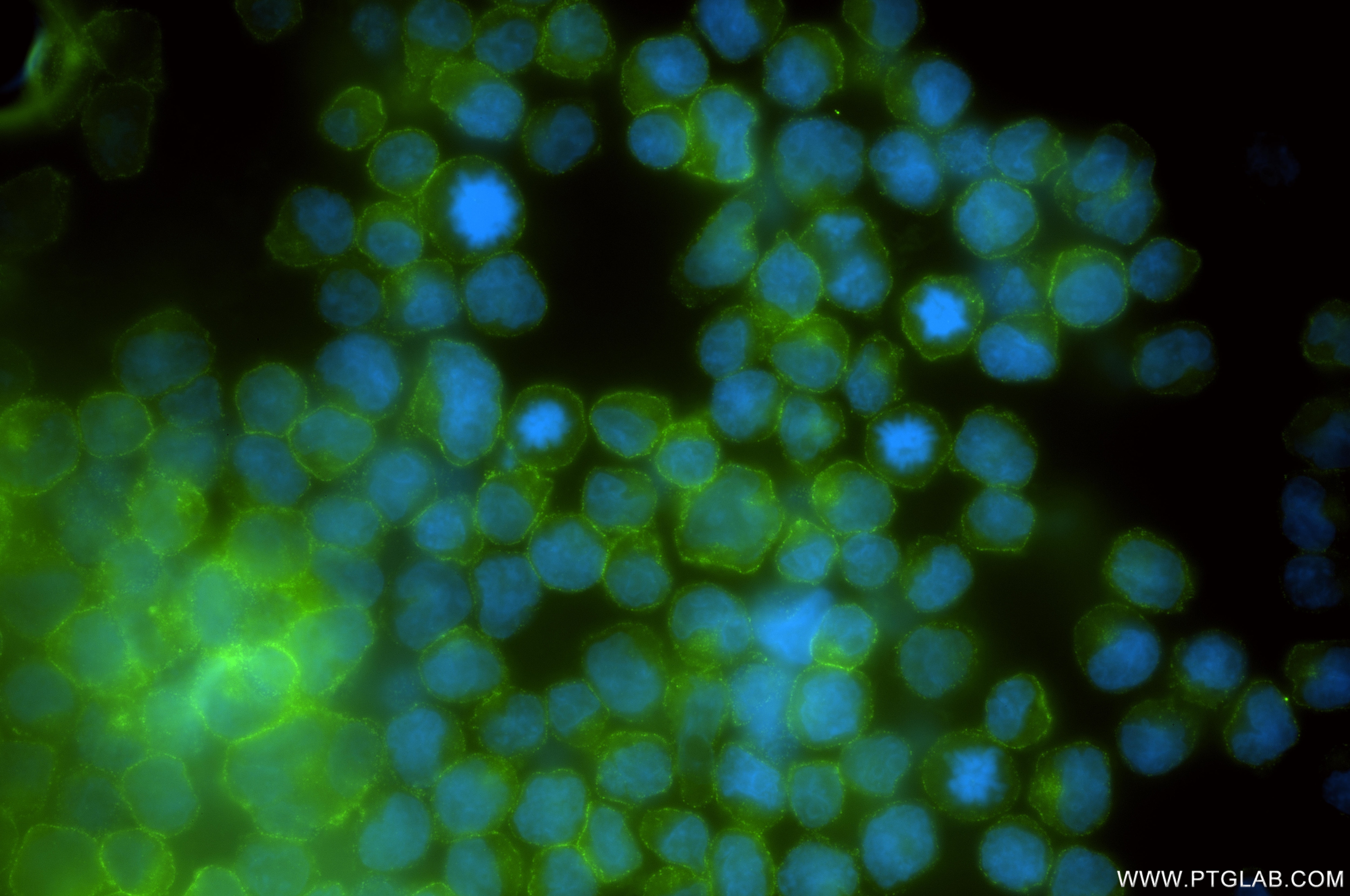 Immunofluorescence (IF) / fluorescent staining of Raji cells using CD72 Recombinant monoclonal antibody (84270-5-RR)