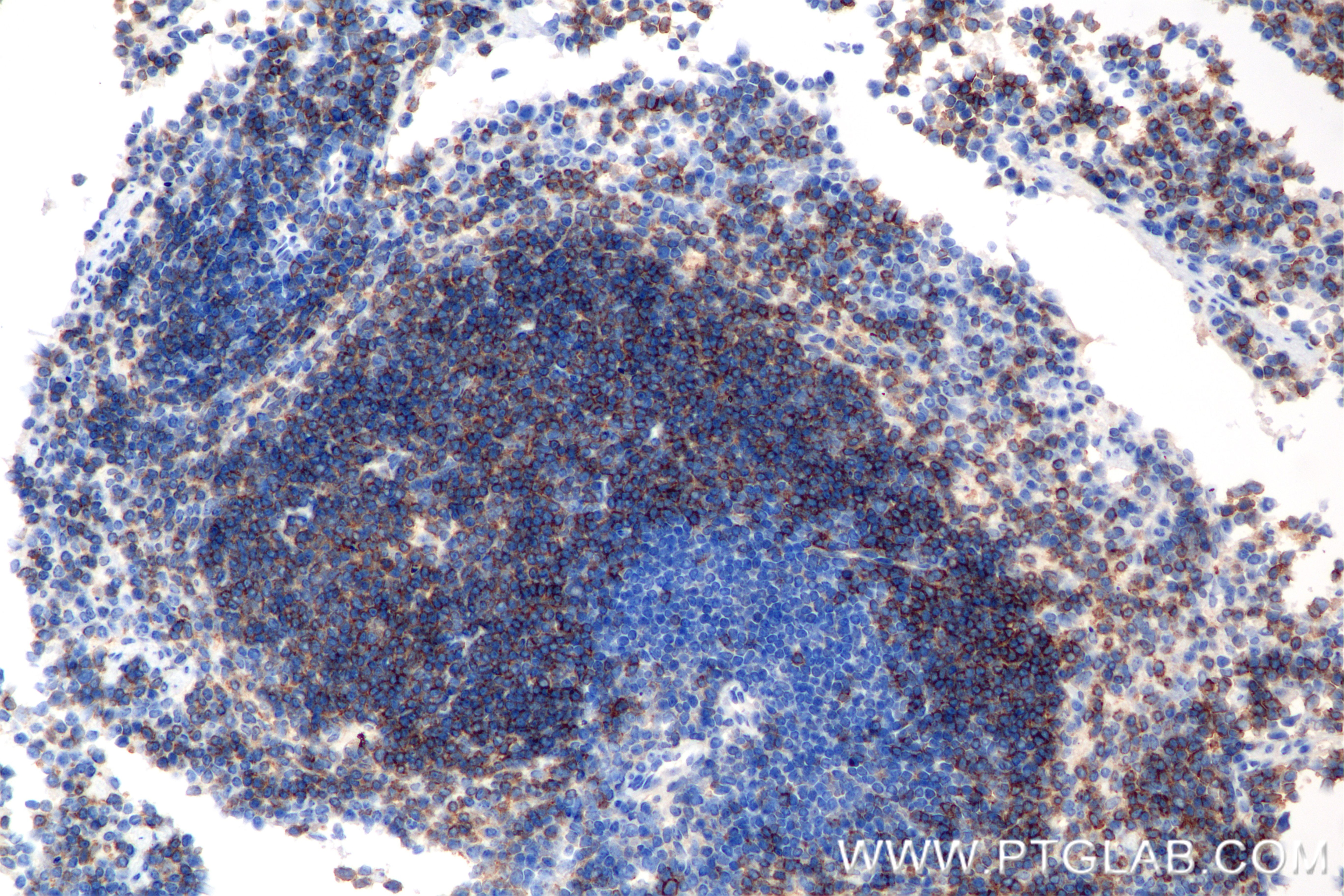 Immunohistochemistry (IHC) staining of mouse spleen tissue using CD72 Recombinant monoclonal antibody (85208-5-RR)
