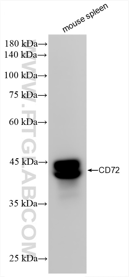Western Blot (WB) analysis of mouse spleen tissue using CD72 Recombinant antibody (85208-5-RR)