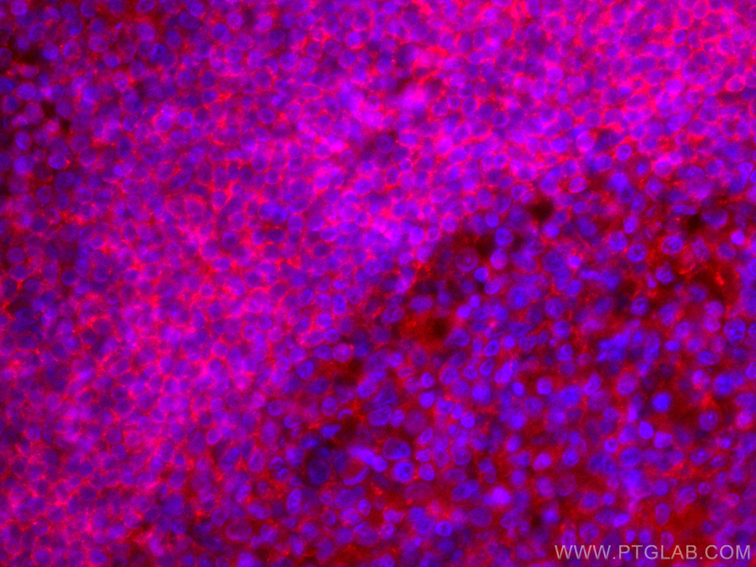 Immunofluorescence (IF) / fluorescent staining of human tonsillitis tissue using CoraLite®594-conjugated CD72 Monoclonal antibody (CL594-67424)