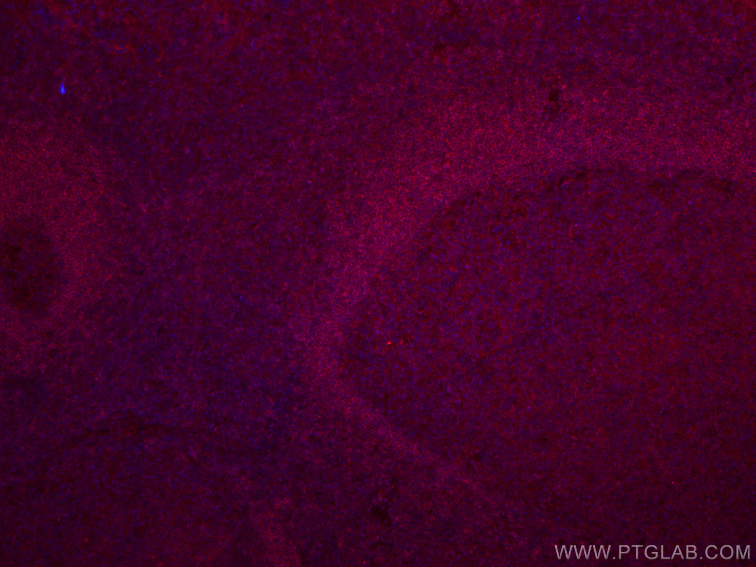 Immunofluorescence (IF) / fluorescent staining of human tonsillitis tissue using CoraLite®594-conjugated CD72 Monoclonal antibody (CL594-67424)