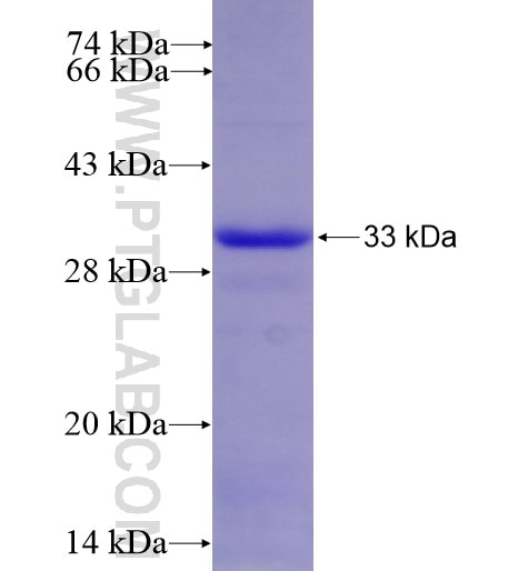 CD72 fusion protein Ag14405 SDS-PAGE