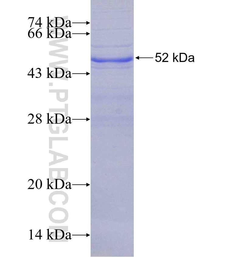 CD72 fusion protein Ag4262 SDS-PAGE