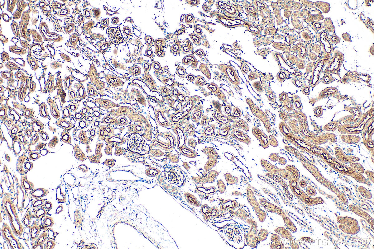 Immunohistochemistry (IHC) staining of mouse kidney tissue using CD73 Polyclonal antibody (32131-1-AP)