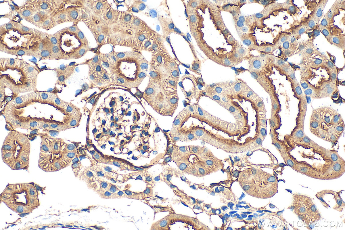 Immunohistochemistry (IHC) staining of mouse kidney tissue using CD73 Polyclonal antibody (32131-1-AP)