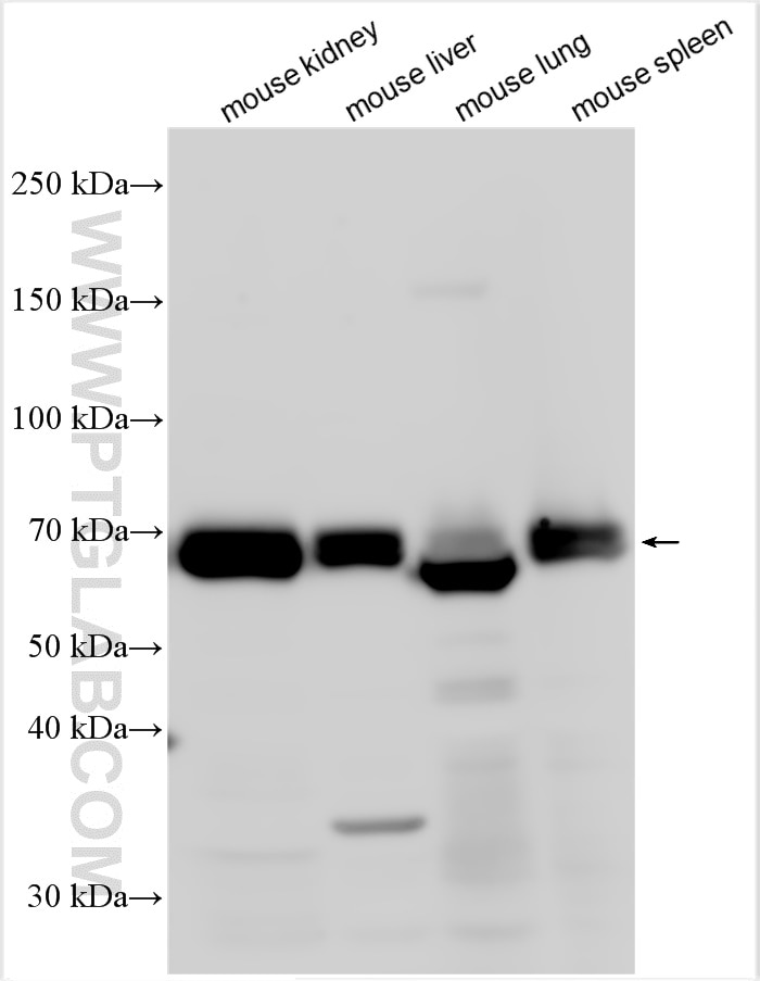 Western Blot (WB) analysis of various lysates using CD73 Polyclonal antibody (32131-1-AP)