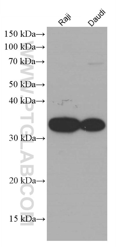 Western Blot (WB) analysis of various lysates using CD74 Monoclonal antibody (66390-1-Ig)