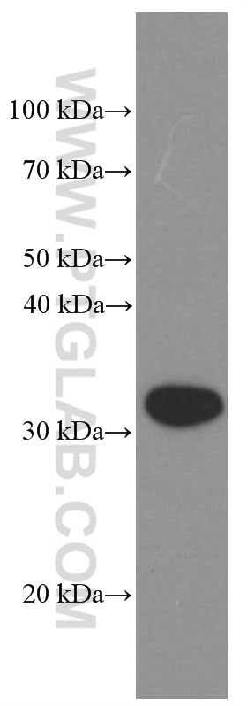 CD74 Monoclonal antibody