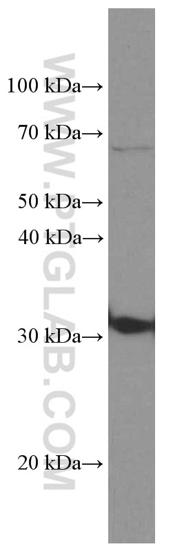 Western Blot (WB) analysis of Ramos cells using CD74 Monoclonal antibody (66390-1-Ig)