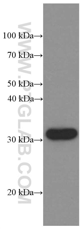 Western Blot (WB) analysis of Daudi cells using CD74 Monoclonal antibody (66390-1-Ig)