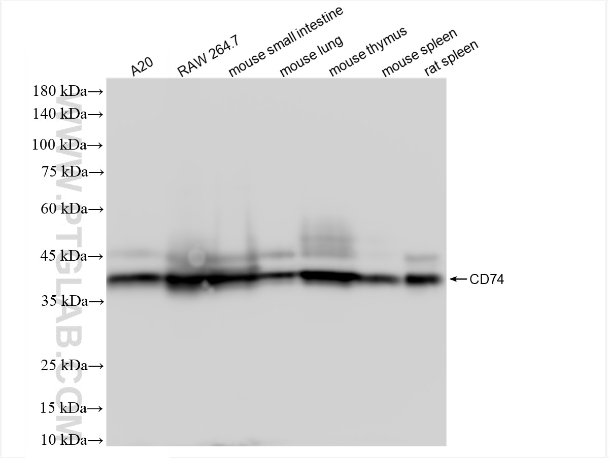 Western Blot (WB) analysis of various lysates using CD74 Recombinant antibody (85802-1-RR)