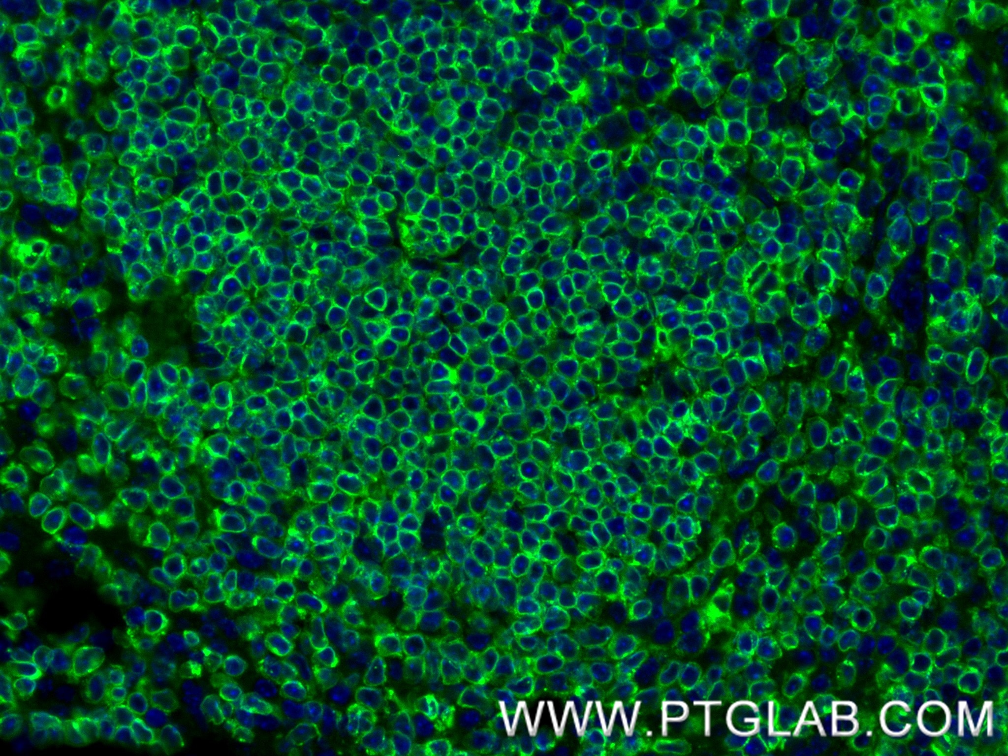 Immunofluorescence (IF) / fluorescent staining of mouse spleen tissue using CD74 Recombinant monoclonal antibody (85802-2-RR)