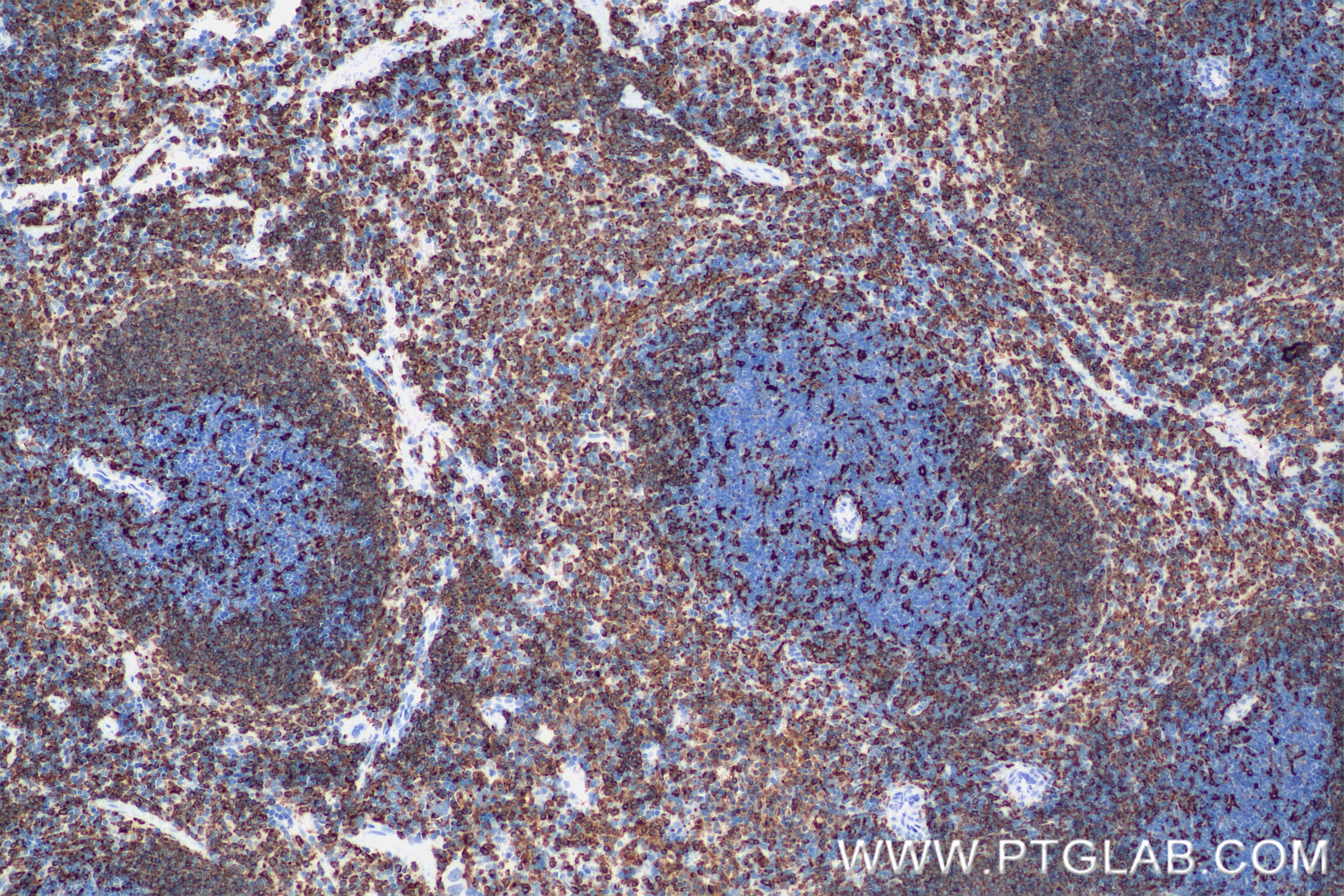 Immunohistochemistry (IHC) staining of mouse spleen tissue using CD74 Recombinant antibody (85802-2-RR)