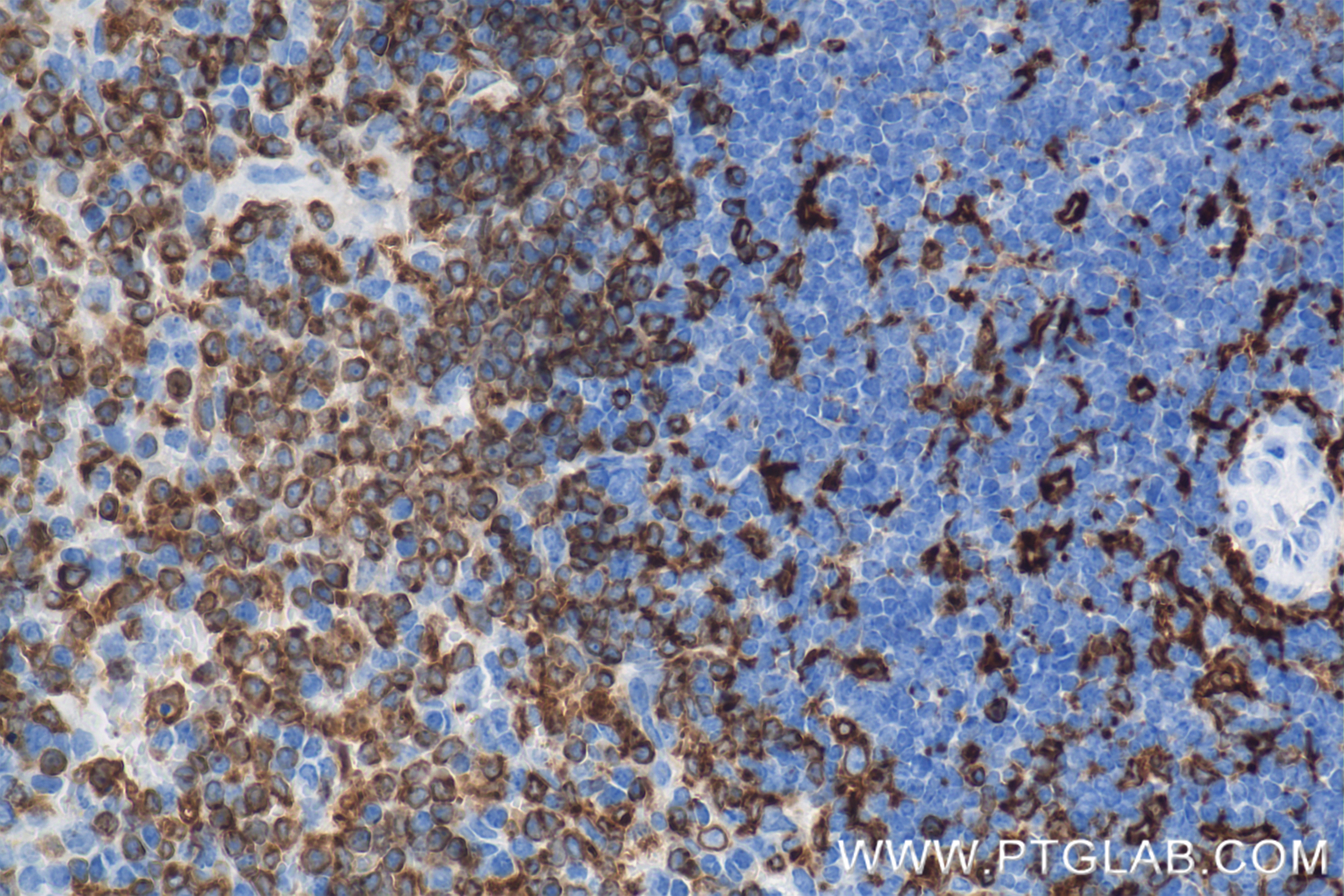Immunohistochemistry (IHC) staining of mouse spleen tissue using CD74 Recombinant antibody (85802-2-RR)