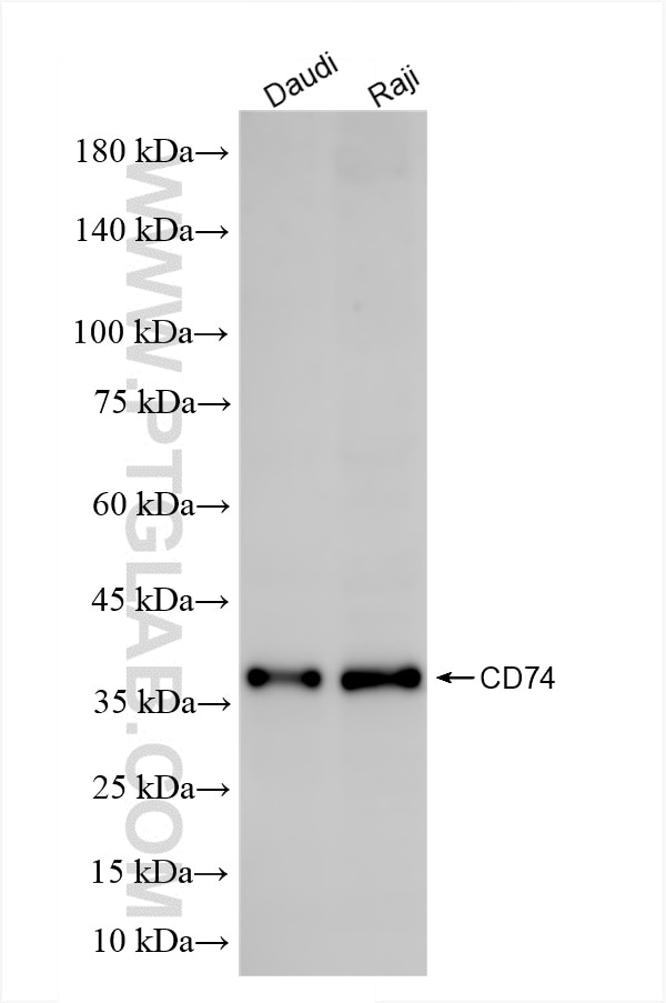 Western Blot (WB) analysis of various lysates using CD74 Recombinant antibody (86023-5-RR)