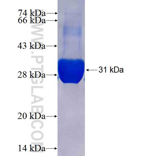 CD74 fusion protein Ag25499 SDS-PAGE