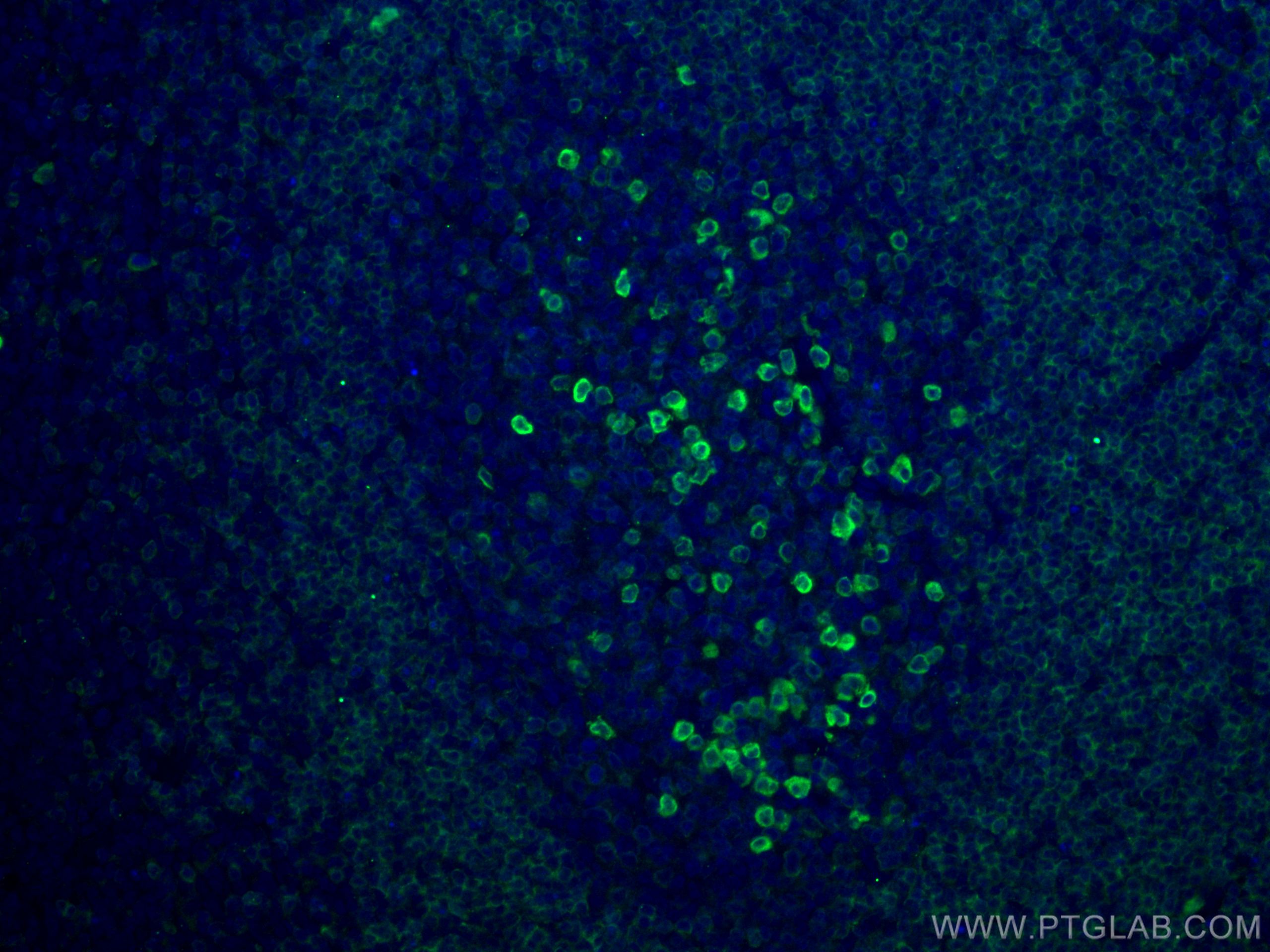 Immunofluorescence (IF) / fluorescent staining of human tonsillitis tissue using CD79A Polyclonal antibody (22349-1-AP)