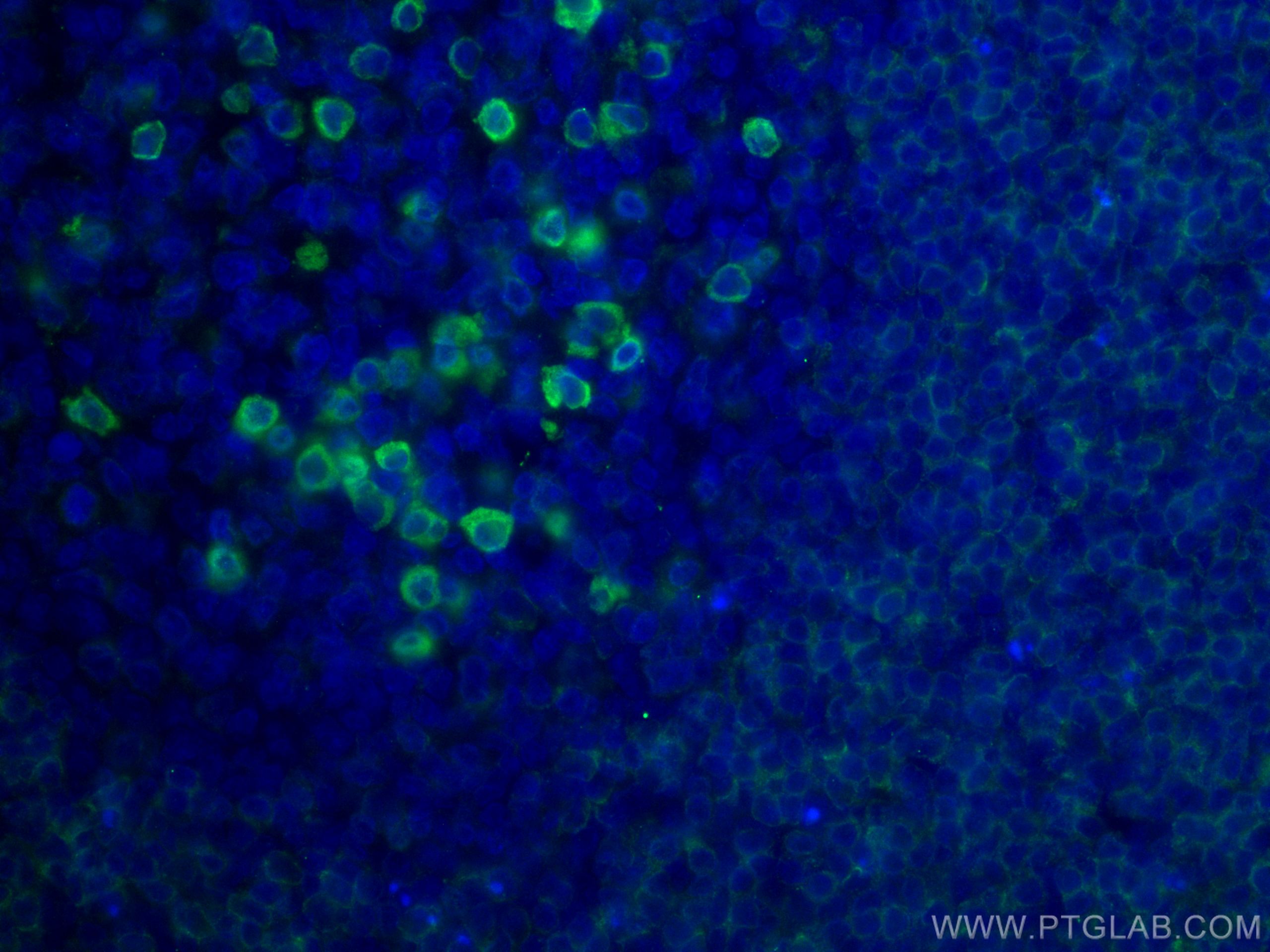 Immunofluorescence (IF) / fluorescent staining of human tonsillitis tissue using CD79A Polyclonal antibody (22349-1-AP)