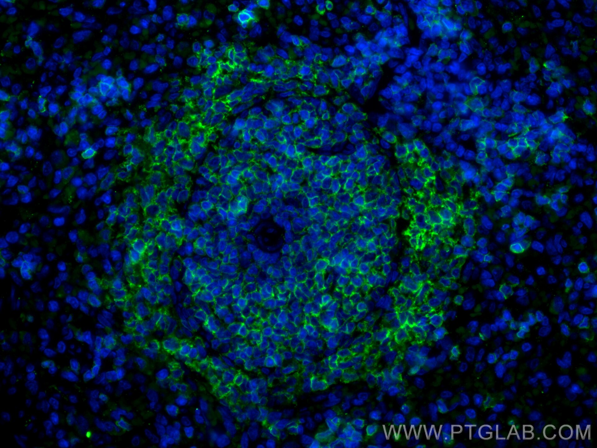 Immunofluorescence (IF) / fluorescent staining of rat spleen tissue using CD79a Polyclonal antibody (31887-1-AP)