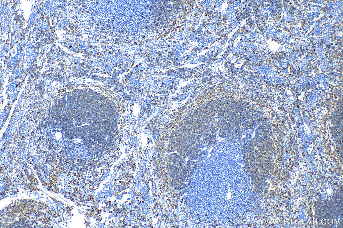 Immunohistochemistry (IHC) staining of mouse spleen tissue using CD79A Polyclonal antibody (31887-1-AP)