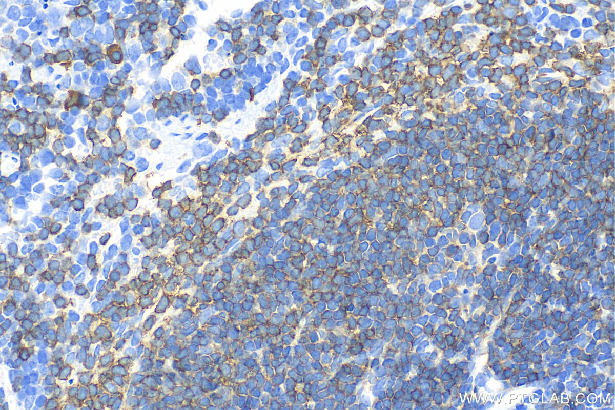 Immunohistochemistry (IHC) staining of mouse spleen tissue using CD79A Polyclonal antibody (31887-1-AP)