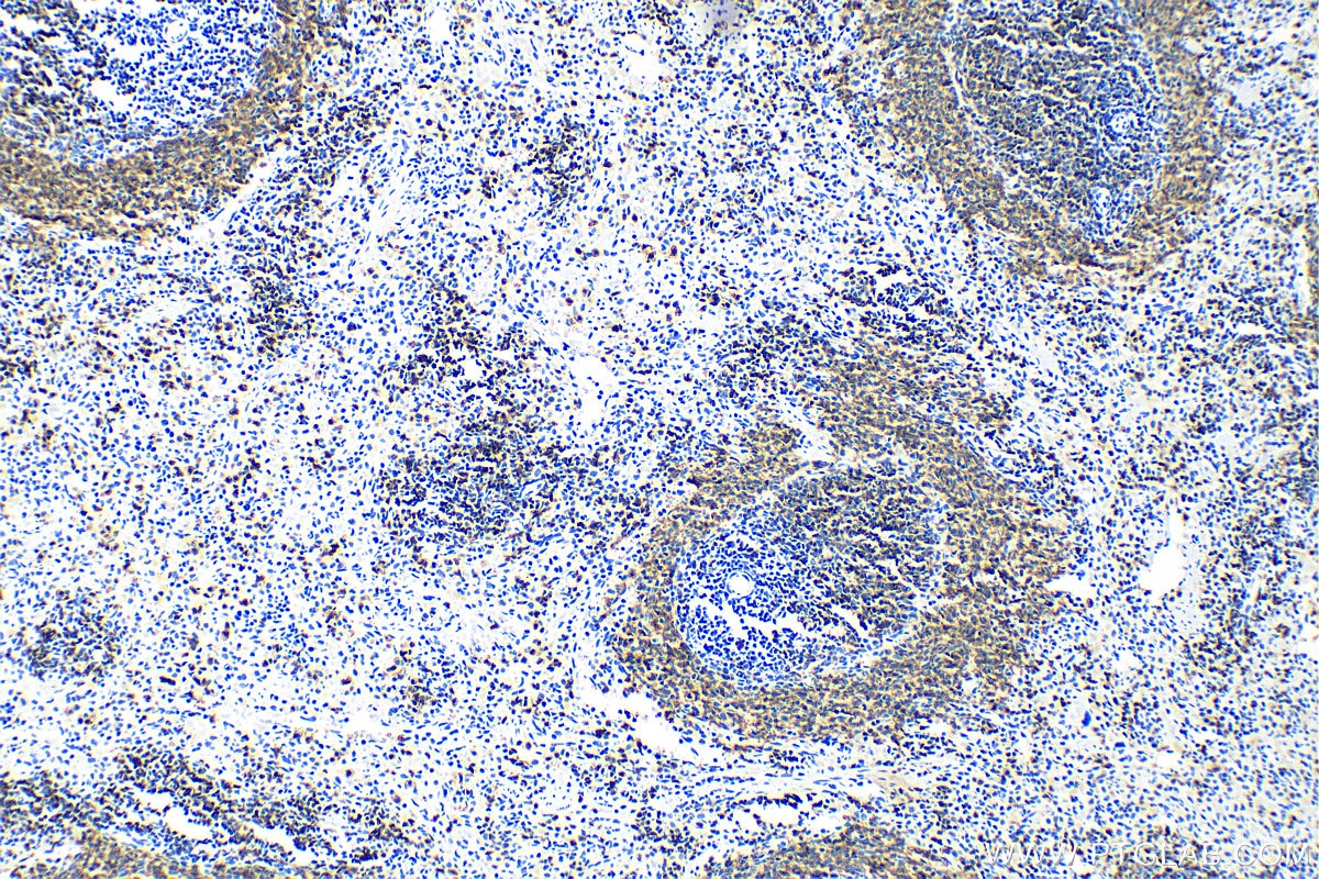 Immunohistochemistry (IHC) staining of rat spleen tissue using CD79A Polyclonal antibody (31887-1-AP)