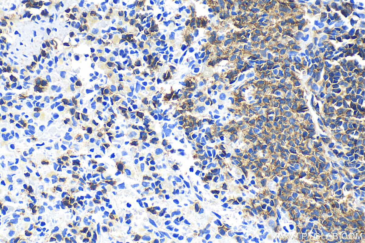 Immunohistochemistry (IHC) staining of rat spleen tissue using CD79A Polyclonal antibody (31887-1-AP)