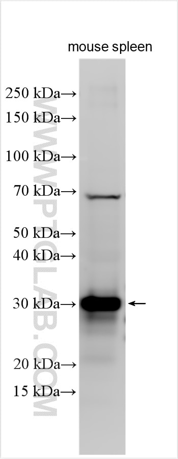 Western Blot (WB) analysis of various lysates using CD79A Polyclonal antibody (31887-1-AP)