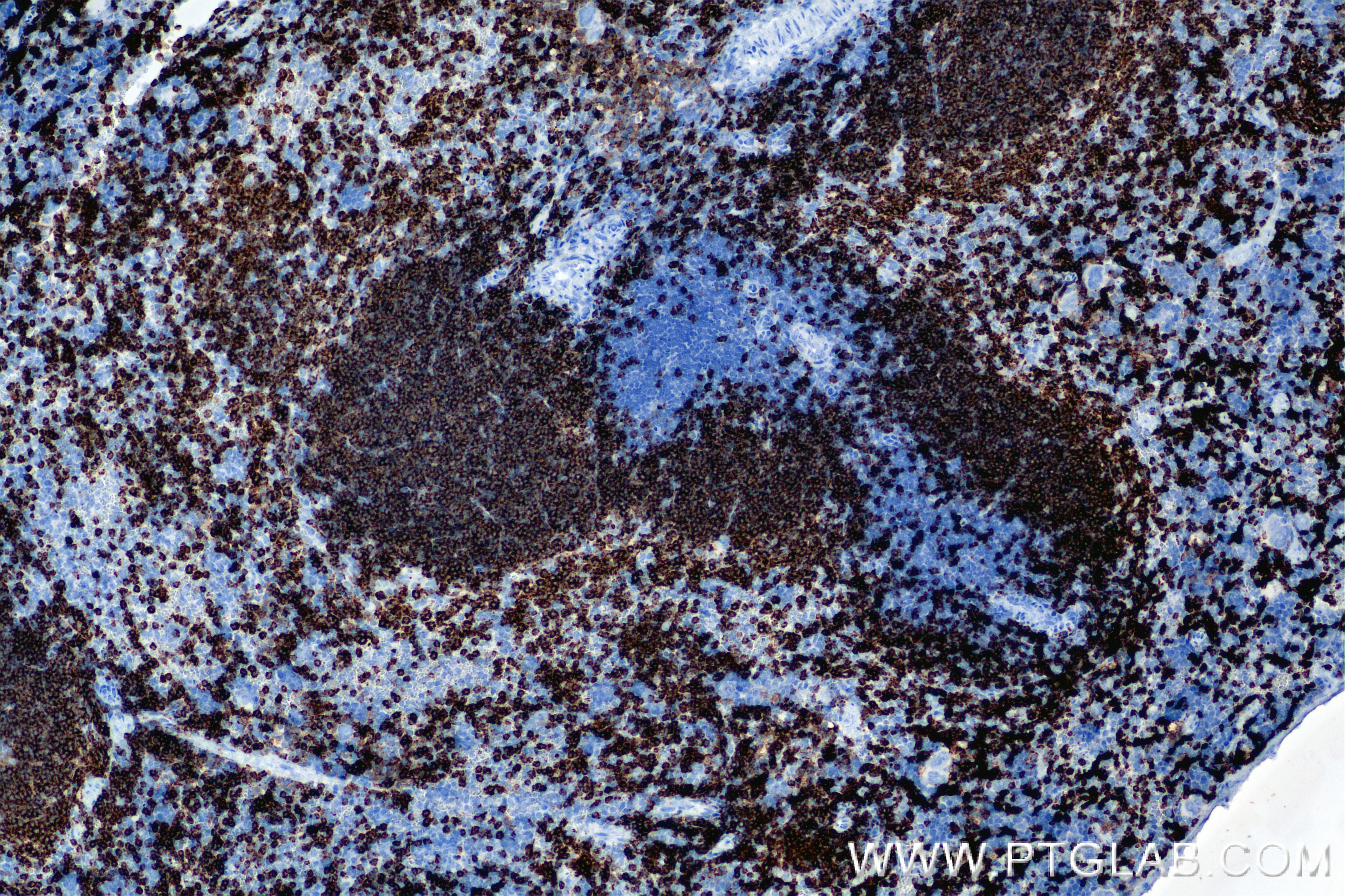 Immunohistochemistry (IHC) staining of mouse spleen tissue using CD79A Recombinant antibody (85881-3-RR)