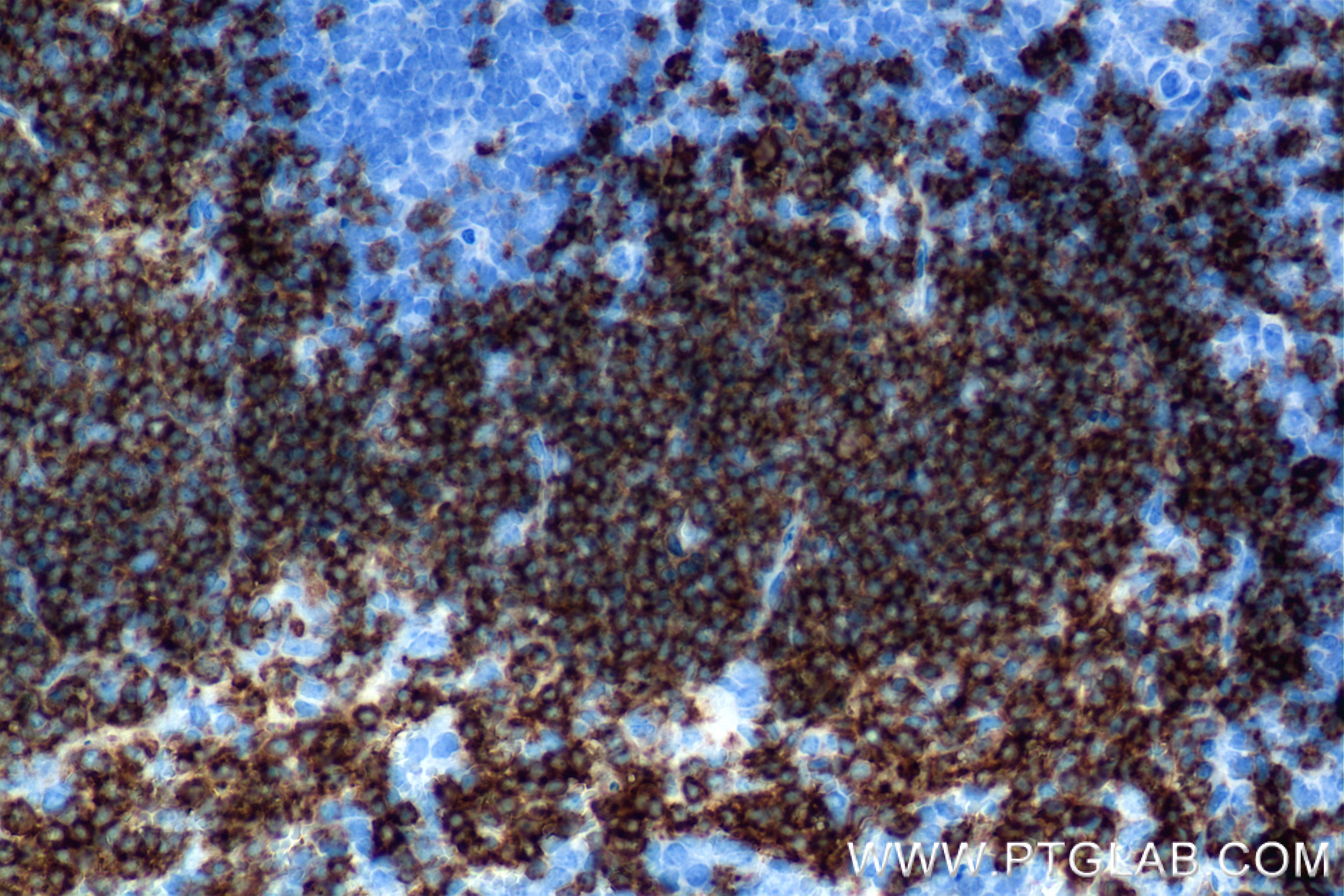 Immunohistochemistry (IHC) staining of mouse spleen tissue using CD79A Recombinant antibody (85881-3-RR)