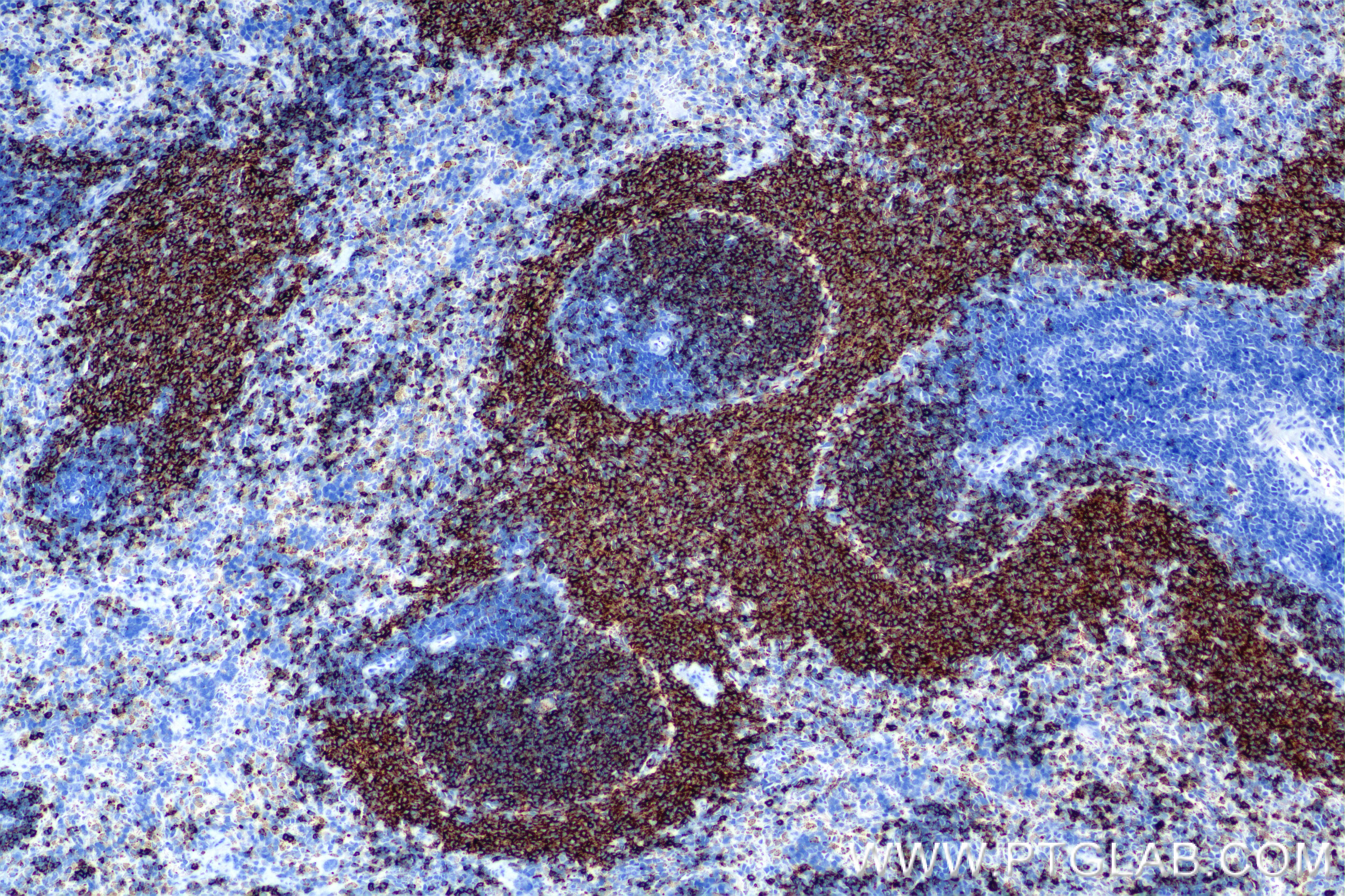 Immunohistochemistry (IHC) staining of rat spleen tissue using CD79A Recombinant antibody (85881-3-RR)