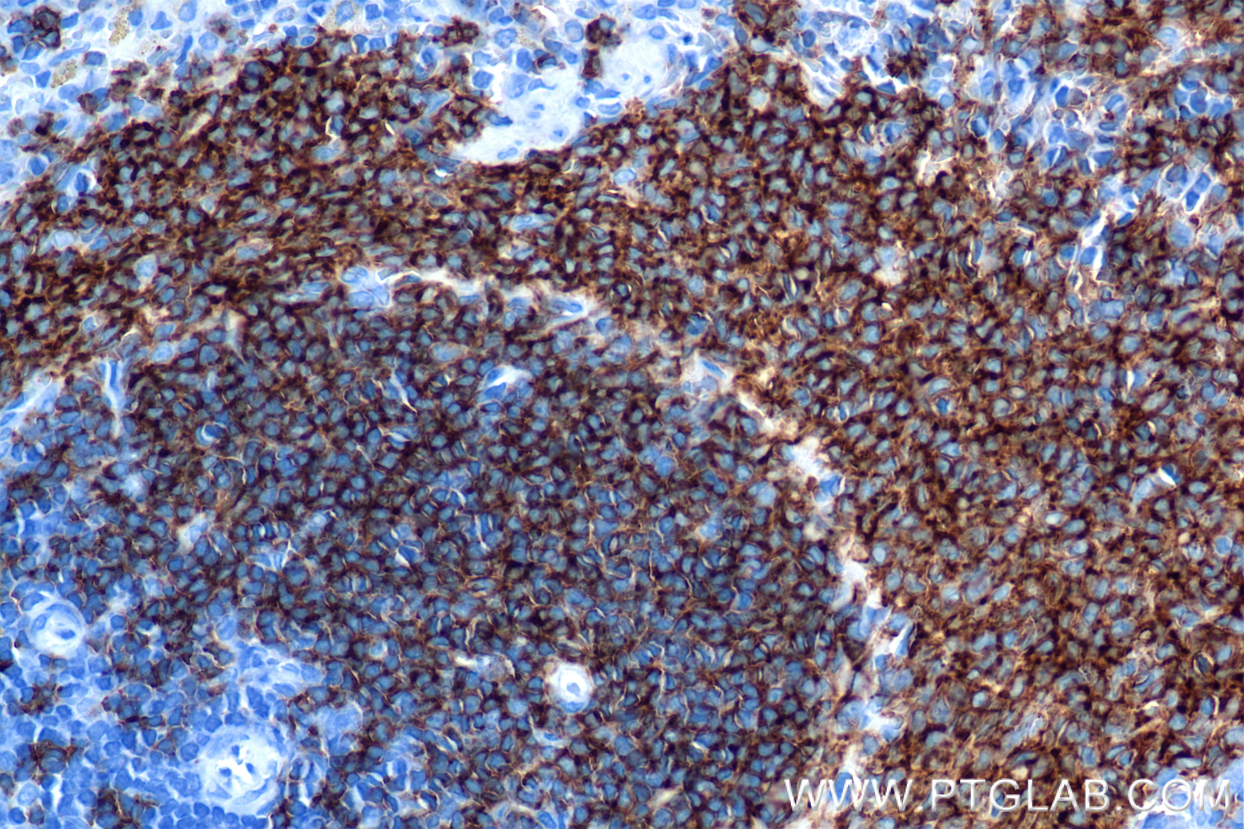 Immunohistochemistry (IHC) staining of rat spleen tissue using CD79A Recombinant antibody (85881-3-RR)