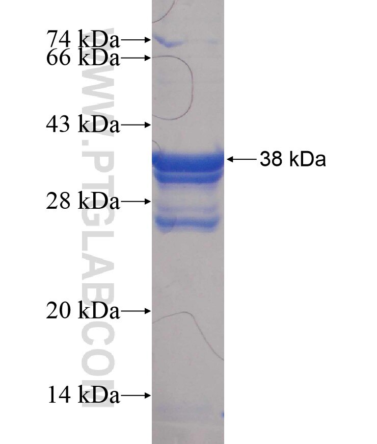 CD79A fusion protein Ag17924 SDS-PAGE